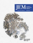 JEM
