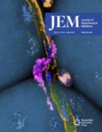 JEM 