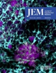 JEM
