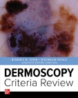 Dermoscopy Criteria...