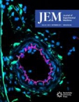 JEM
