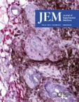 JEM