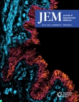JEM