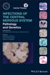 Infections of the...