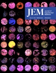 JEM