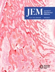 JEM