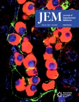 JEM