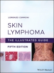 Skin Lymphoma: The...