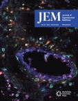 JEM
