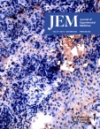 JEM