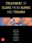 Treatment Of Scars...