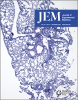 JEM