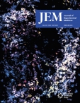 JEM