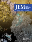 JEM