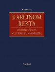 Karcinom rekta, od...