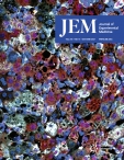 JEM