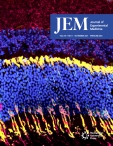 JEM