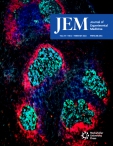 JEM