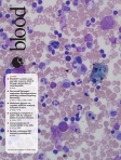 Blood