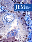 JEM