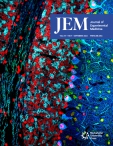 JEM