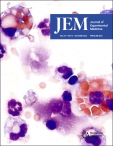 JEM