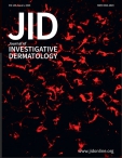 JID