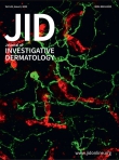 JID