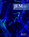 JEM