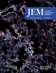JEM