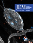JEM