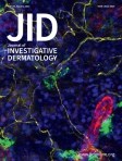 JID