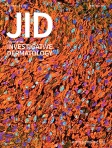 JID