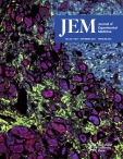 JEM