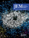 JEM