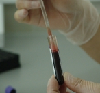 1. 12. světový den HIV/AIDS