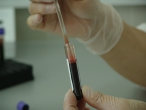 Zpráva o výskytu a šíření HIV/AIDS za rok 2017