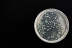 Akční plán pro boj s antibiotickou rezistencí: zlepšit situaci by měla osvětová kampaň i benchmarking