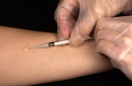 Vědci představili slibnou vakcínu k boji proti tuberkulóze