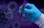 Protilátky na covid-19 na Strakonicku mělo 2,37 procenta testovaných
