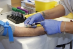 Češi loni podle VZP méně dbali na prevenci. Například počet screeningů na rakovinu tlustého střeva klesl o šestinu